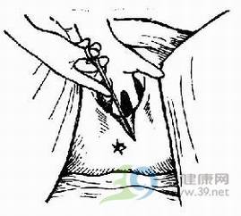 分娩_会阴侧切_顺产会阴侧切手术详解