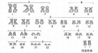 疾病常识_先天愚型
