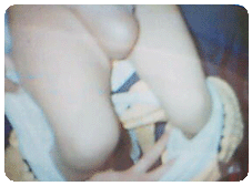 疾病常识_如何发现小儿疝气