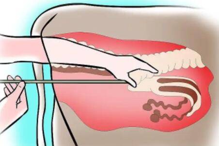牛人工授精的最佳手法_养牛
