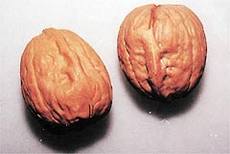 饭后适宜吃健康零食