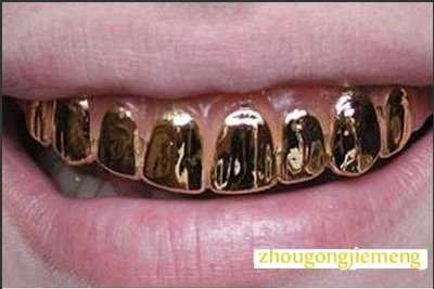 梦见镶金牙齿
