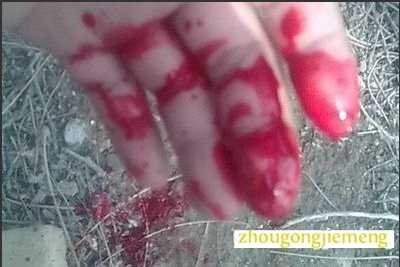 孕妇梦见别人流血