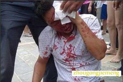 梦见别人要打我